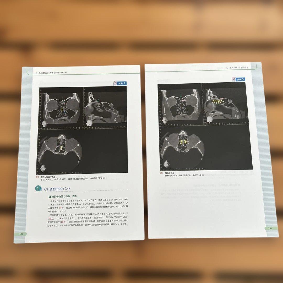 内視鏡下鼻副鼻腔・頭蓋底手術[3DCT画像データDVD-ROM付] CT読影と…