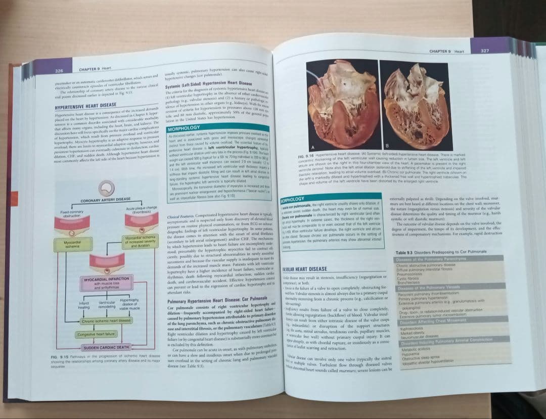 【新品】ROBBINS & KUMAR BASIC PATHOLOGY 第11版