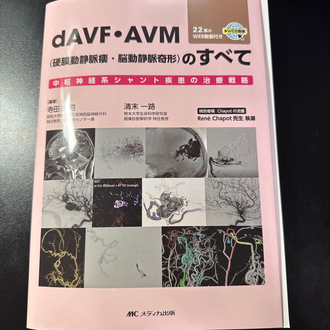 dAVF・AVM(硬膜動静脈瘻・脳動静脈奇形)のすべて 【裁断済】
