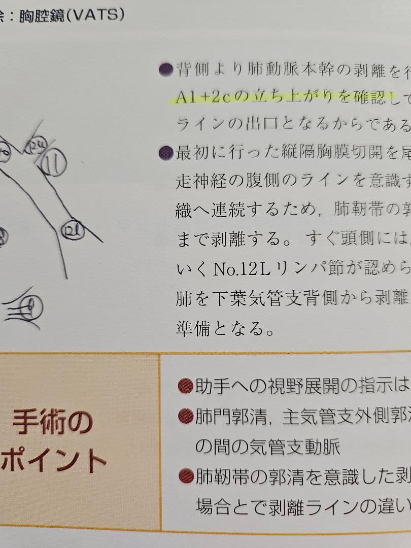がん研スタイル　癌の標準手術　肺癌