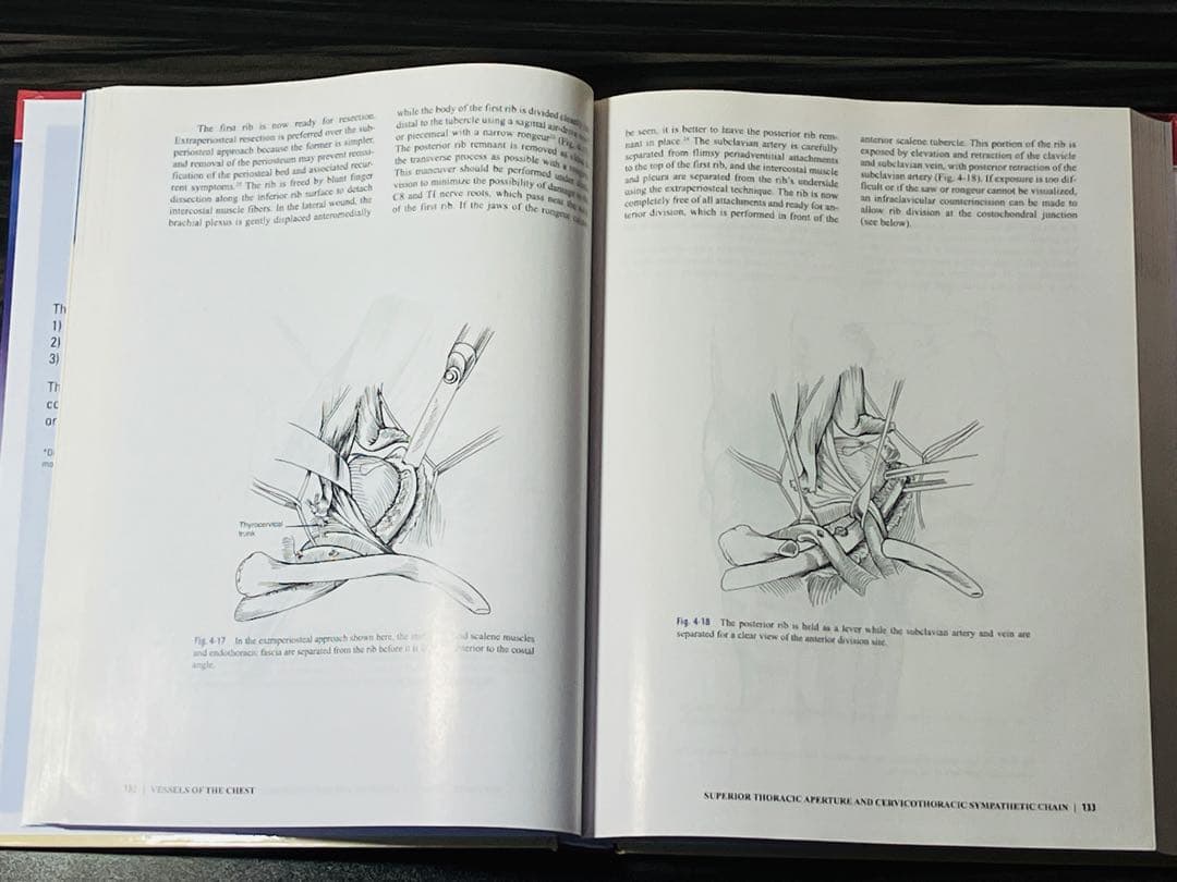 英語版　血管外科における解剖学的露出 医学書　医療