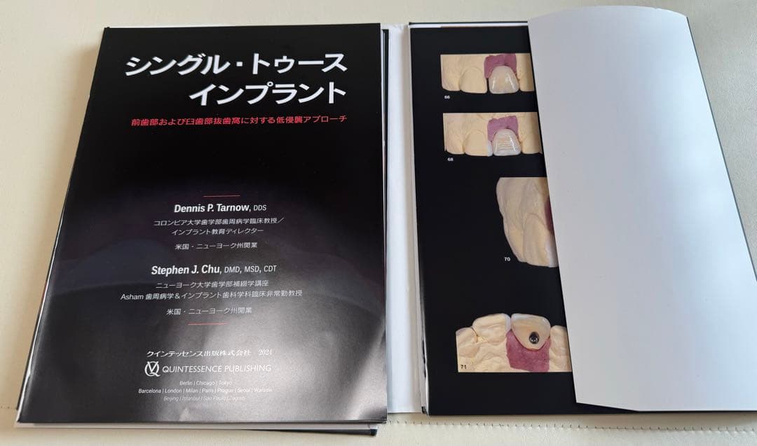 【裁断済】シングル・トゥース インプラント　前歯部および臼歯部抜歯窩に対する低侵