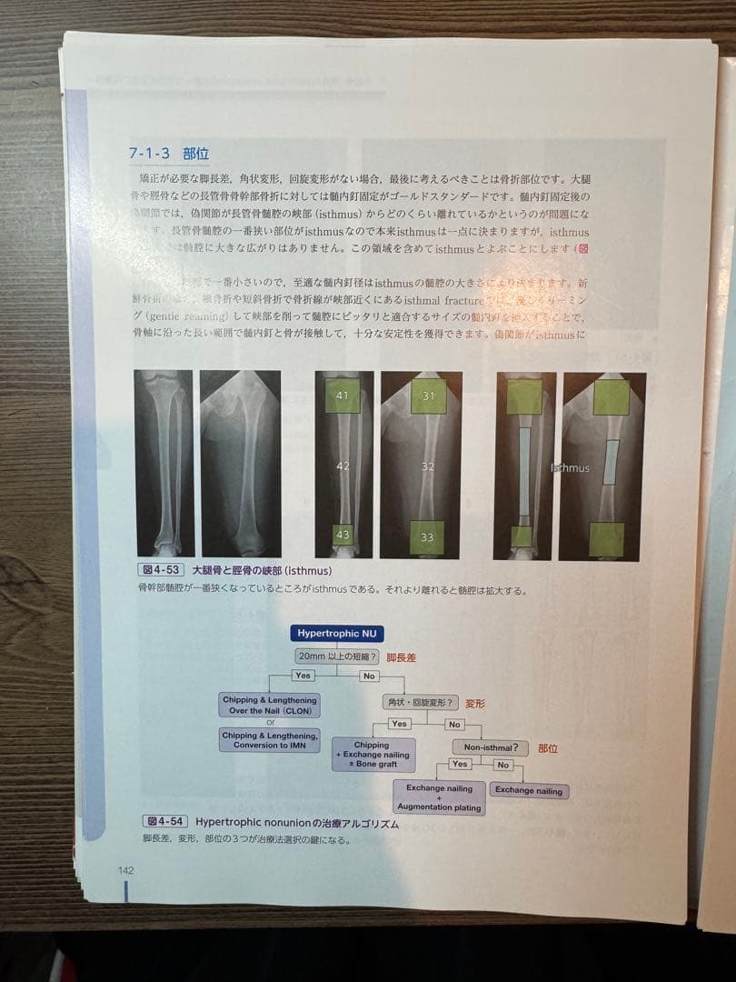骨折合併症 : 白熱講義 : 骨折治療の物理学と生物学 : Nonunion,…