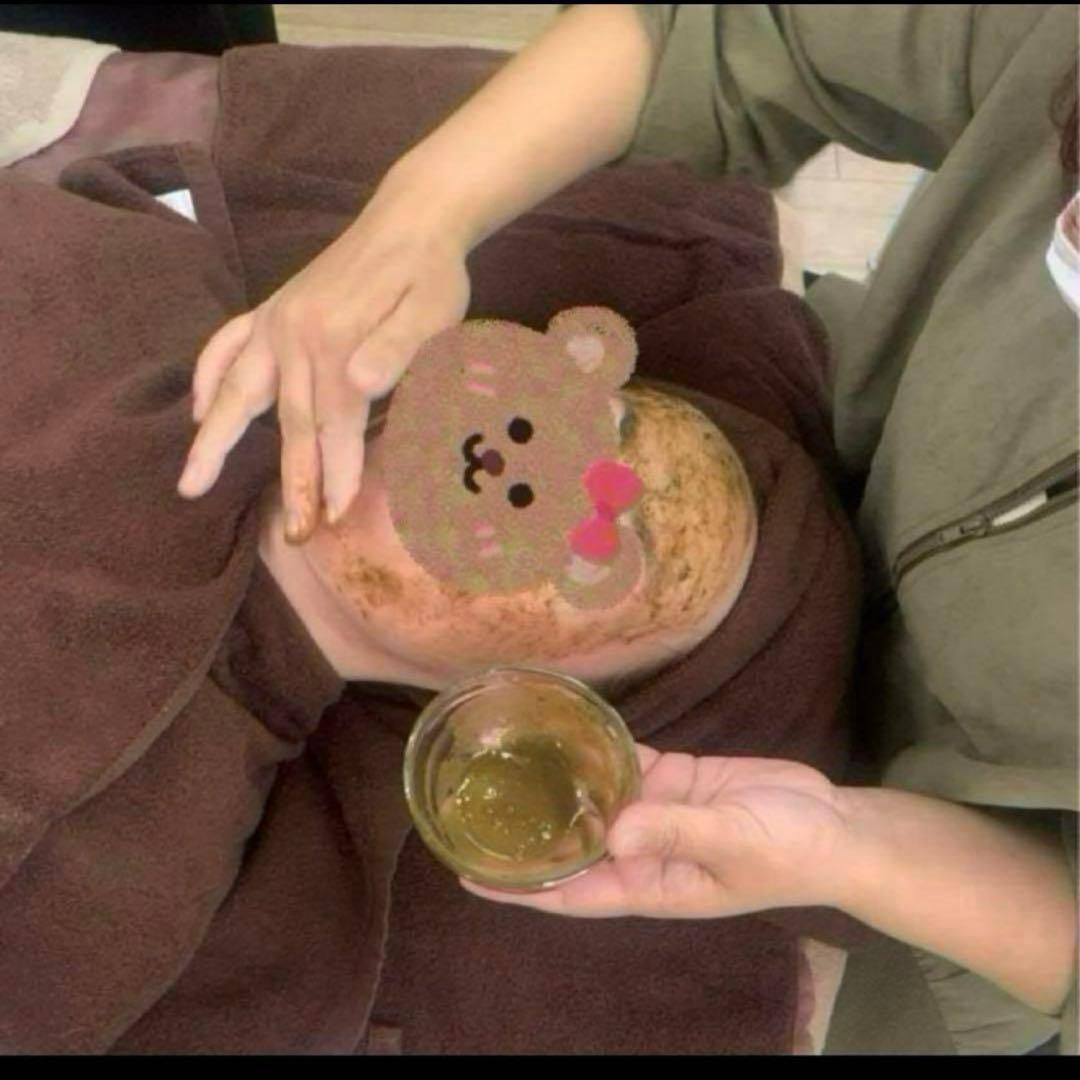 ハーブピーリング剥離無し　10回分（11月11日から2月20日の間発送停止)