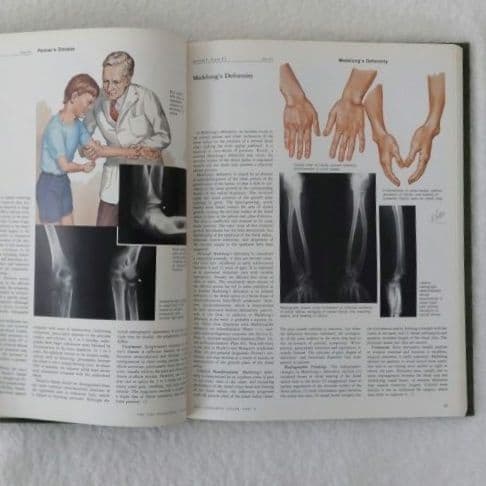 洋書・希少 CIBA医学イラスト集第8巻Ⅰ&Ⅱ フランクH.ネッター／英語版