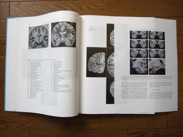 洋書 Duvernoy The Human Brain Second edition