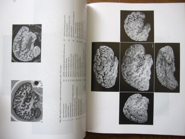 洋書 Duvernoy The Human Brain Second edition