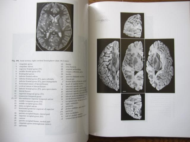 洋書 Duvernoy The Human Brain Second edition