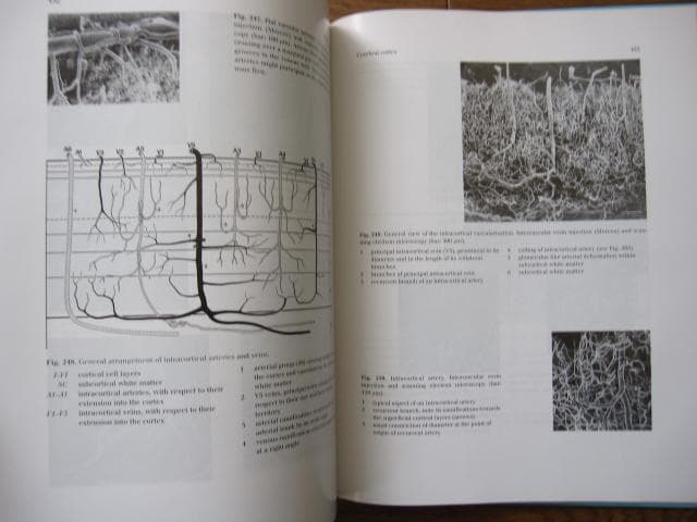 洋書 Duvernoy The Human Brain Second edition