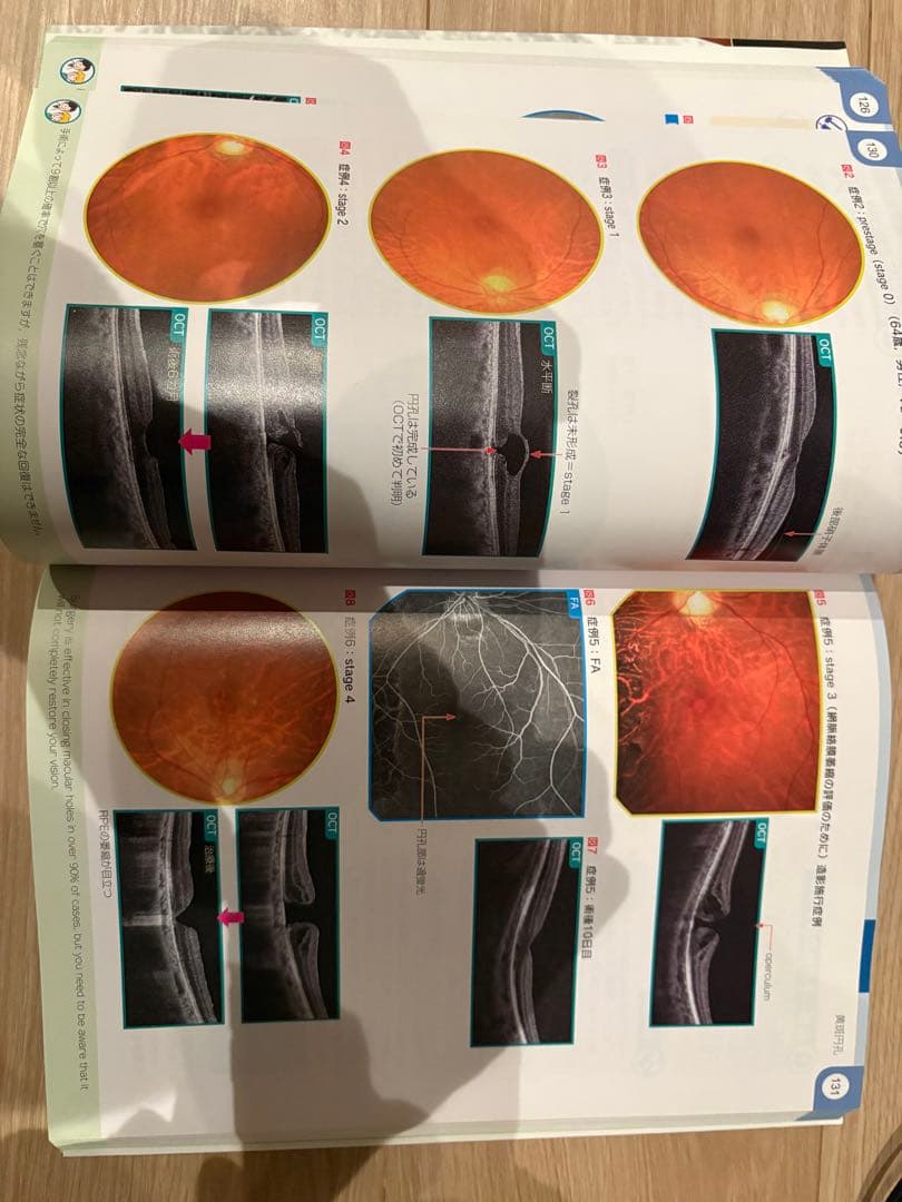 網膜診療クローズアップ 改訂第2版