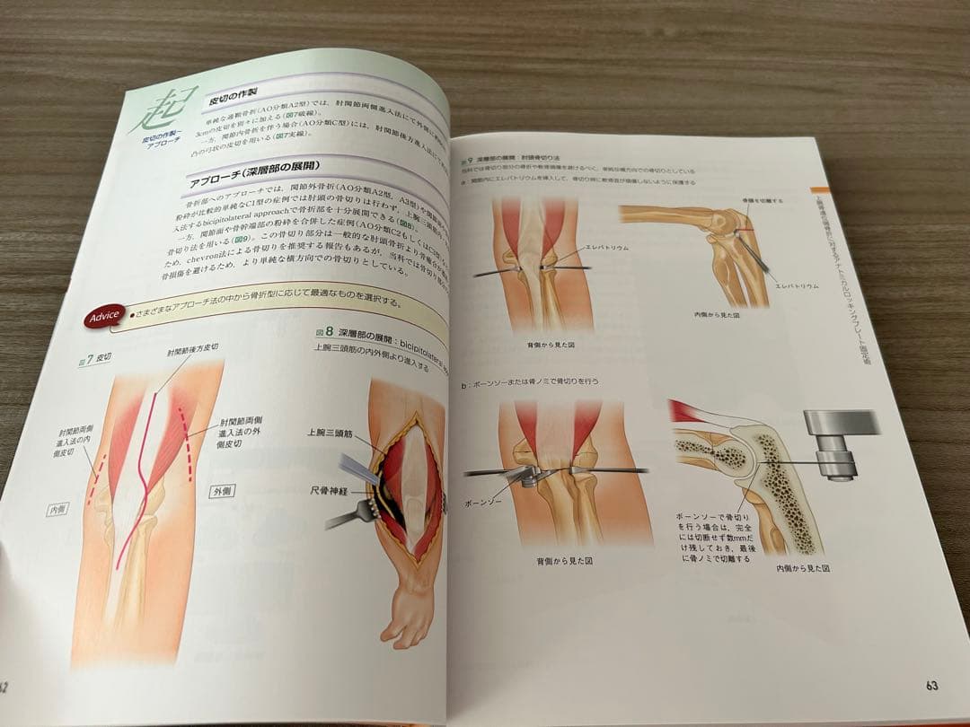 上肢 新執刀医のためのサージカルテクニック