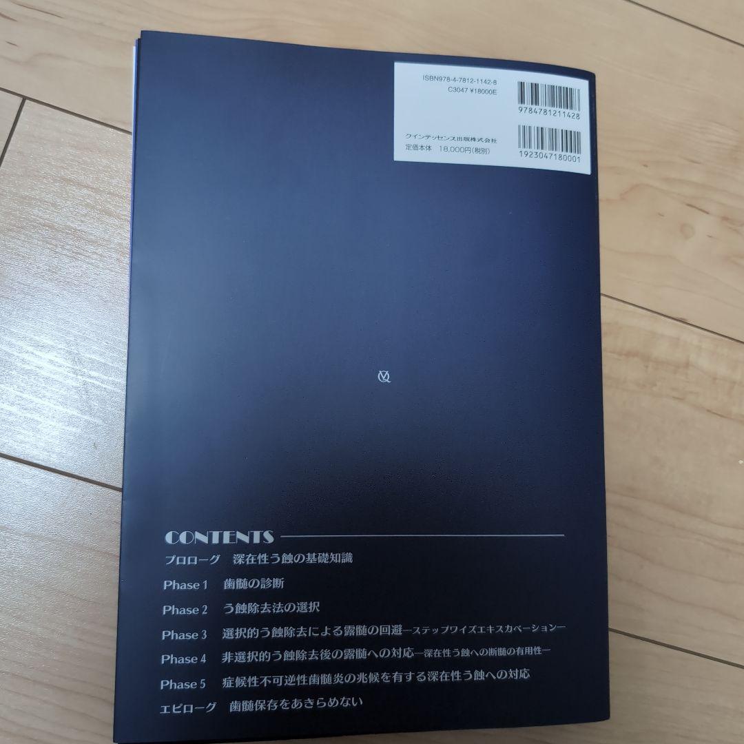 ⚠裁断済　深在性う蝕に対するVital Pulp Therapy　☆