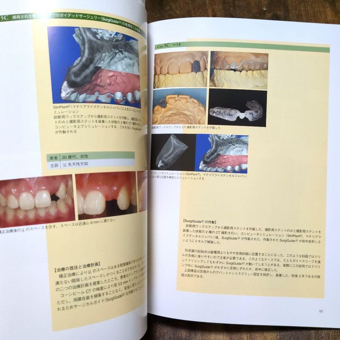インプラントレストレーション vol. III