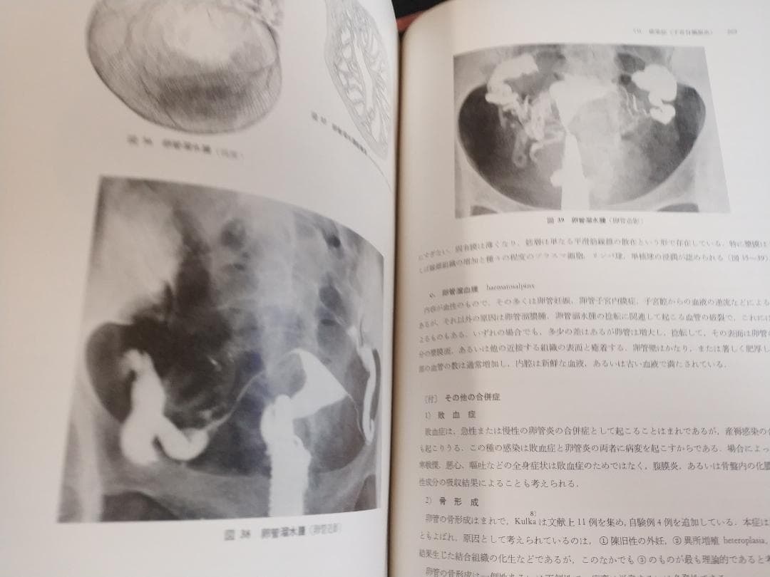 現代産科婦人科学大系〈8A〉女性性器の奇形 発育 位置異常 損傷 炎症1971年
