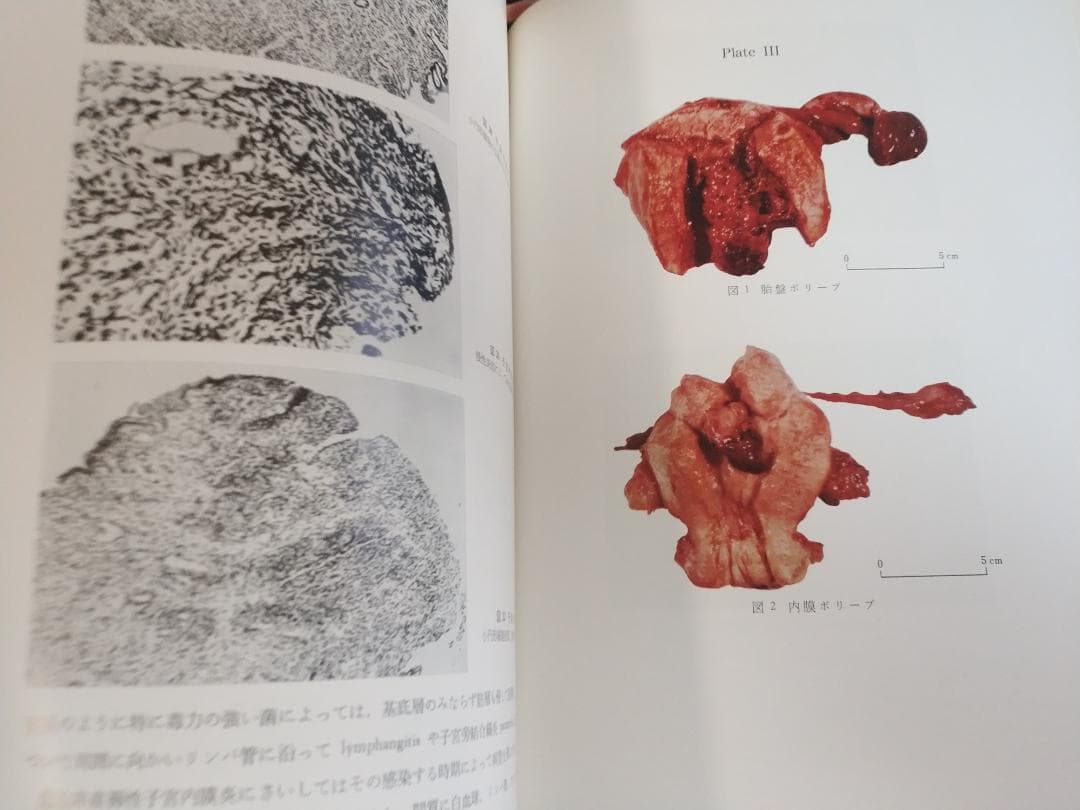 現代産科婦人科学大系〈8A〉女性性器の奇形 発育 位置異常 損傷 炎症1971年