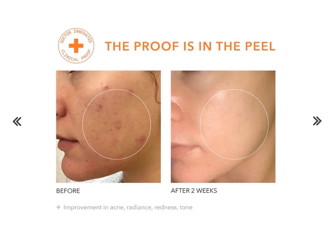 Dr Dennis Grossドクターデニスグロス デイリーピール 45+40)