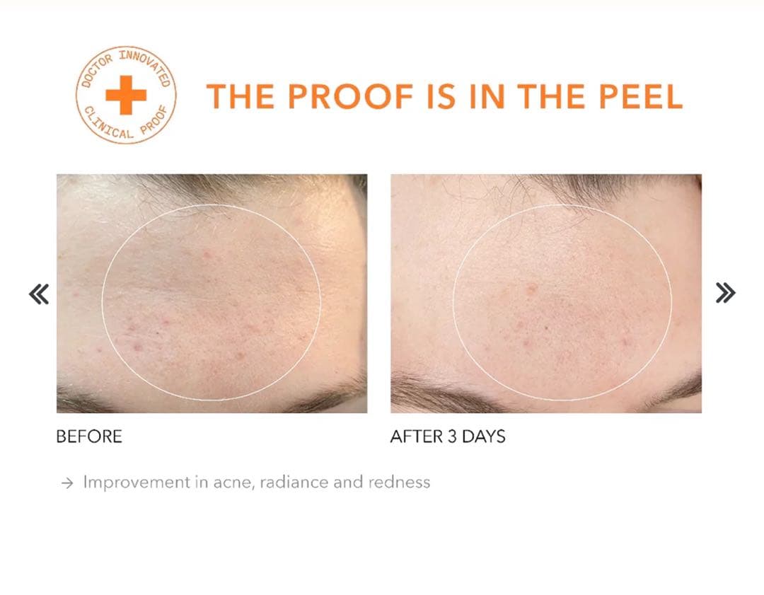 Dr Dennis Grossドクターデニスグロス デイリーピール 45+40)