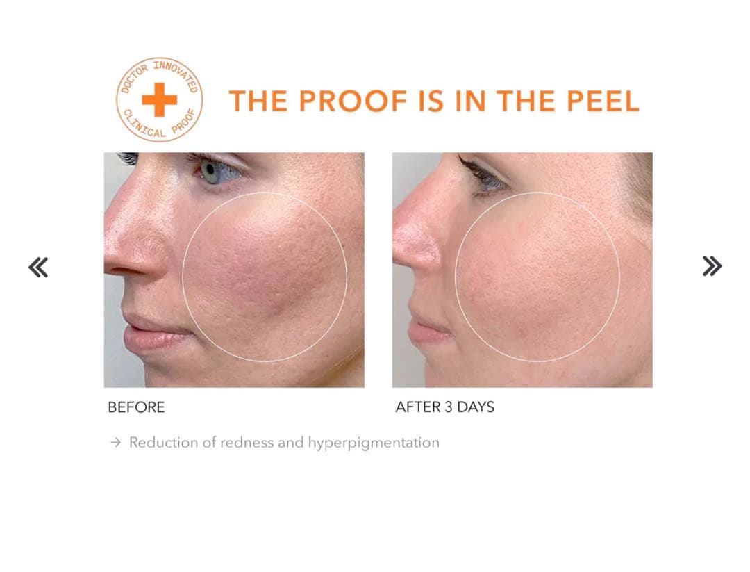 Dr Dennis Grossドクターデニスグロス デイリーピール 45+40)