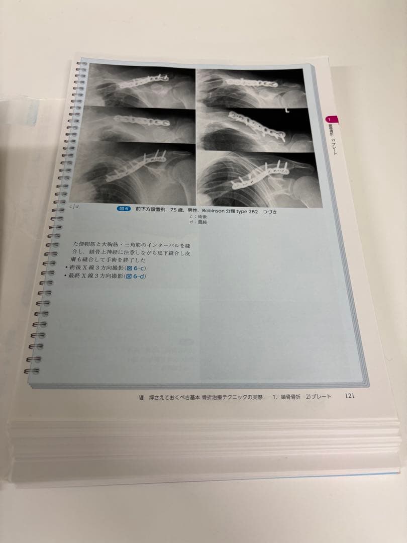 【裁断済】骨折治療基本手技アトラス