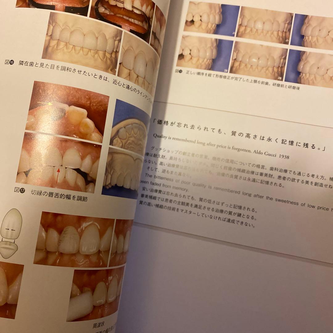 咬合・補綴の臨床マスター