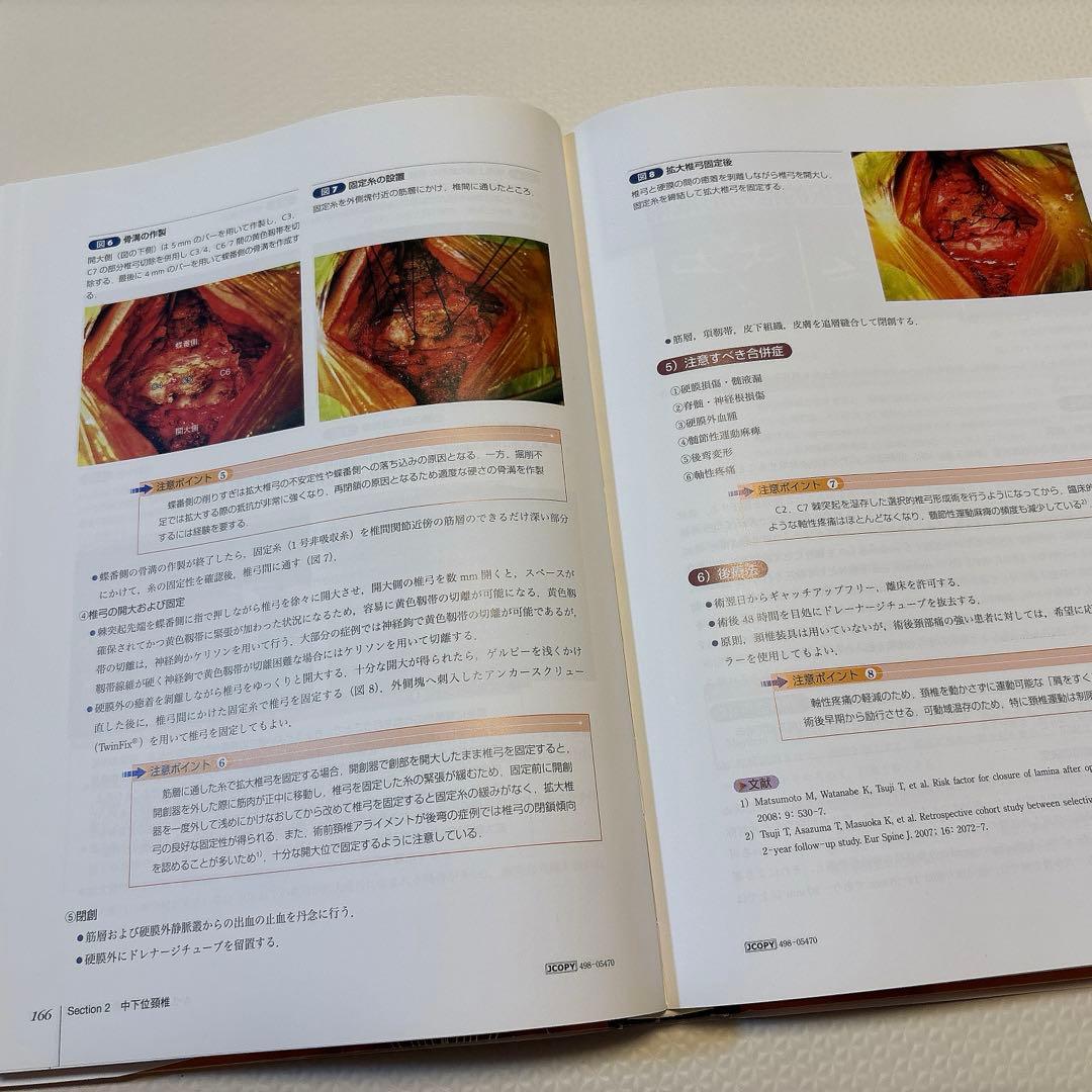 カラーアトラス脊椎・脊髄外科 = Color Atlas of Spine S…