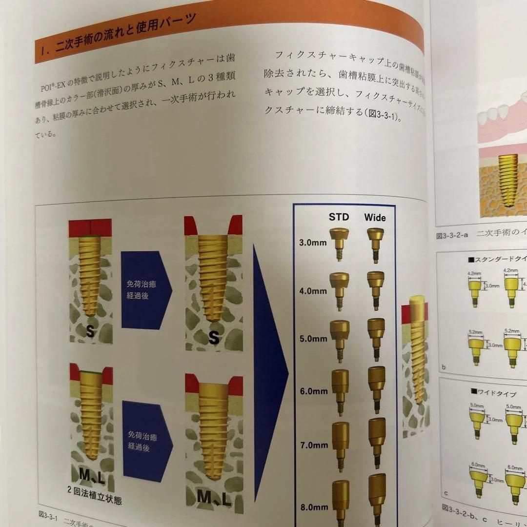 【希少】POI-EX SYSTEMの臨床 2006年版