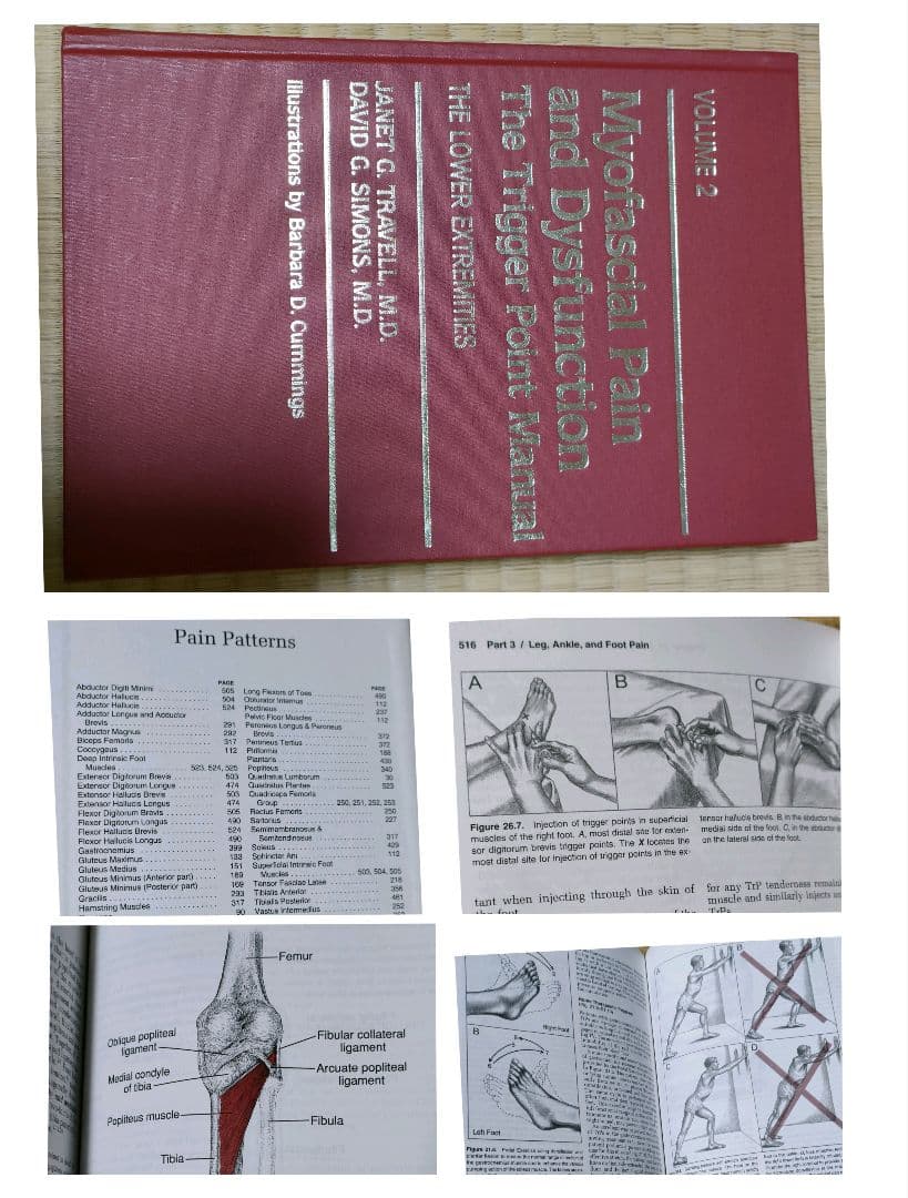 英語版　筋膜痛　筋膜機能障害 トリガーポイント　筋膜性疼痛　下半身