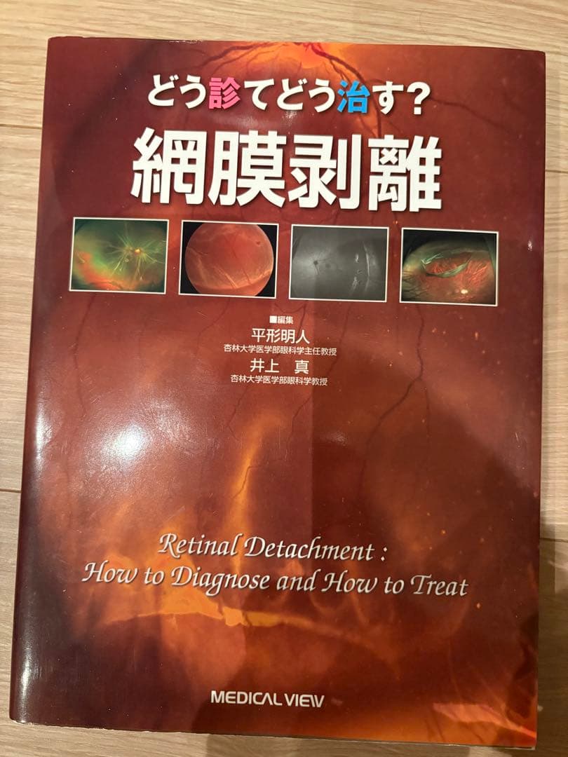 どう診てどう治す？網膜剥離