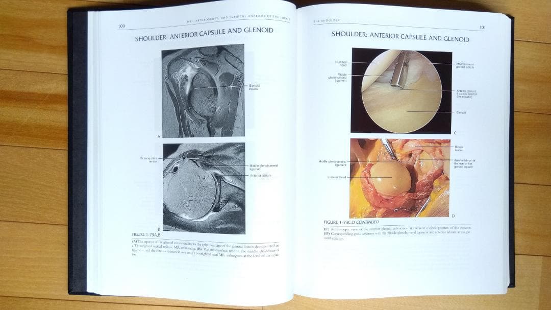 健康・医学 MRI ARTHROSCOPY and SURGICAL ANATOMY