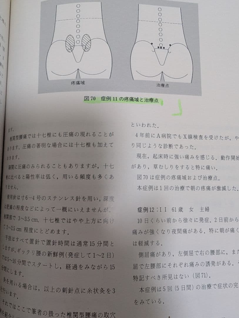 診療法と治療法 開業鍼灸師　鍼灸　5冊セット　出端昭男　医道の日本社　参考書