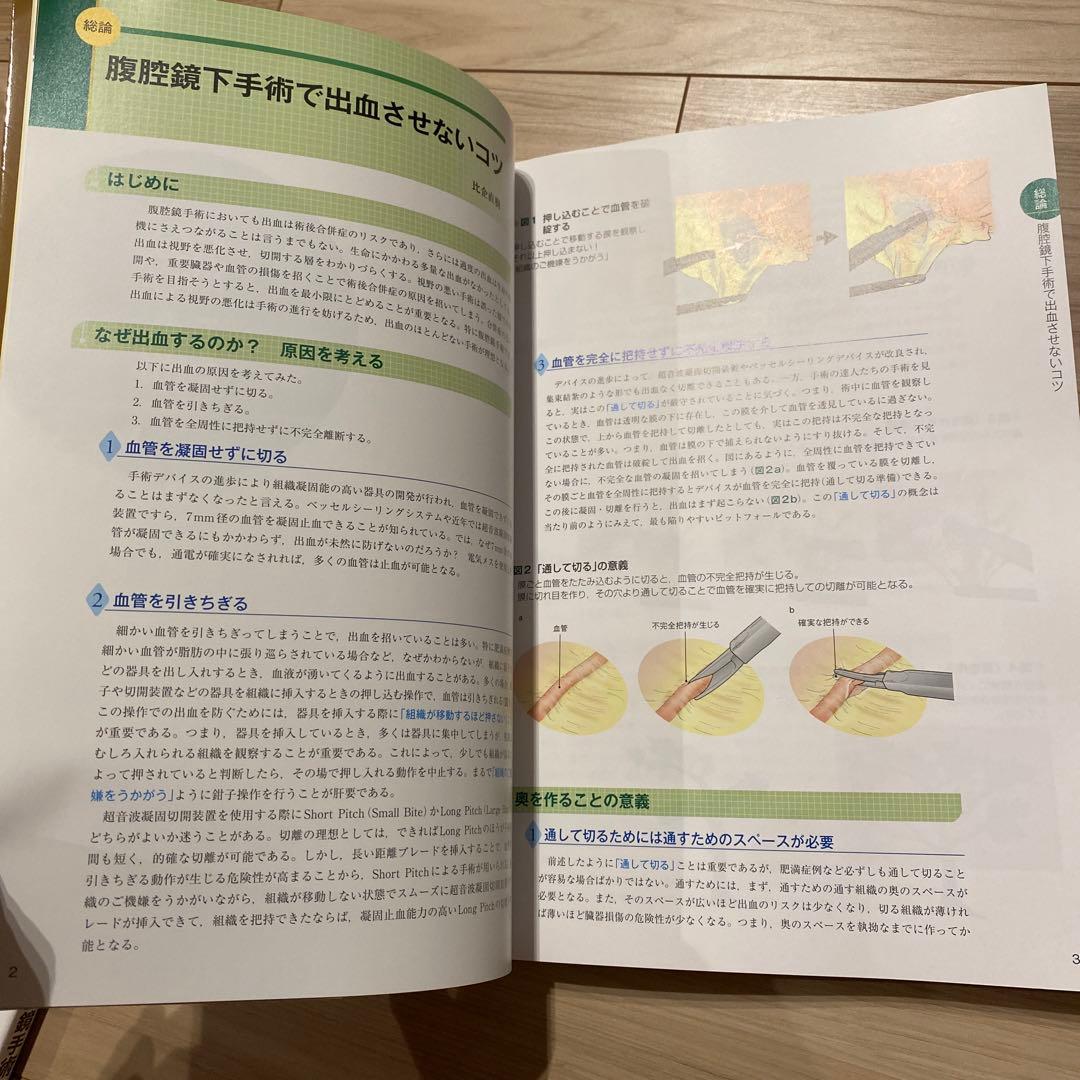 令和スタイル 鏡視下 胃手術のすべて