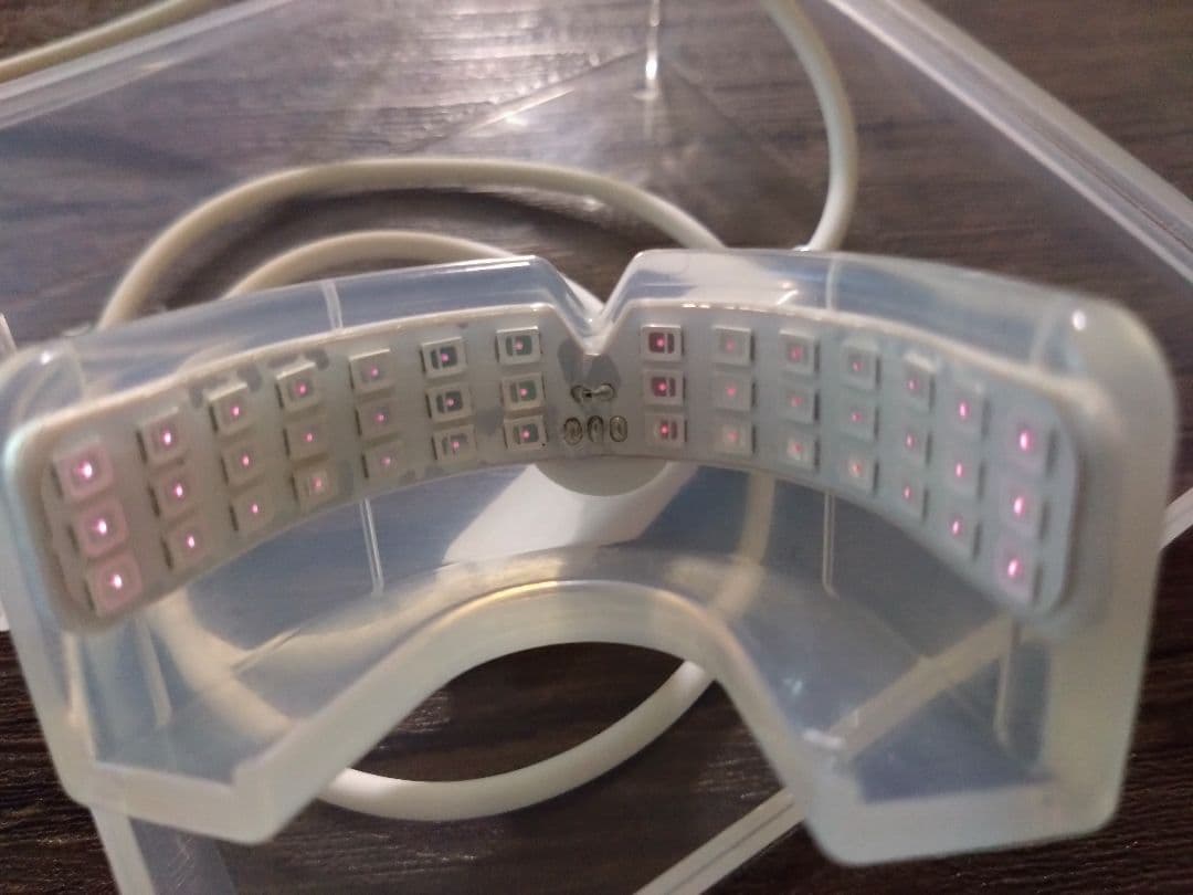 pbm HEALINGヒーリング　歯科矯正　光加速装置　インビザライン