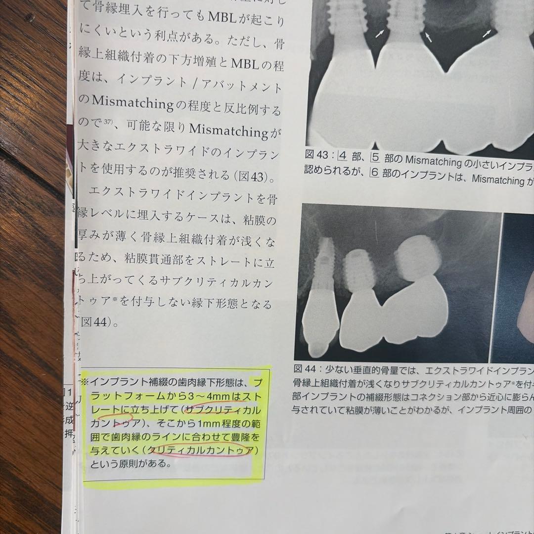 ワイドショートインプラントの基礎と臨床 完全版
