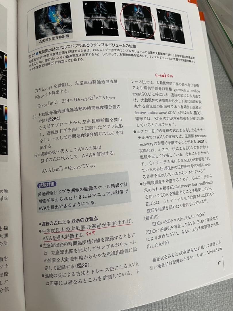 超音波検査士　問題集•参考書