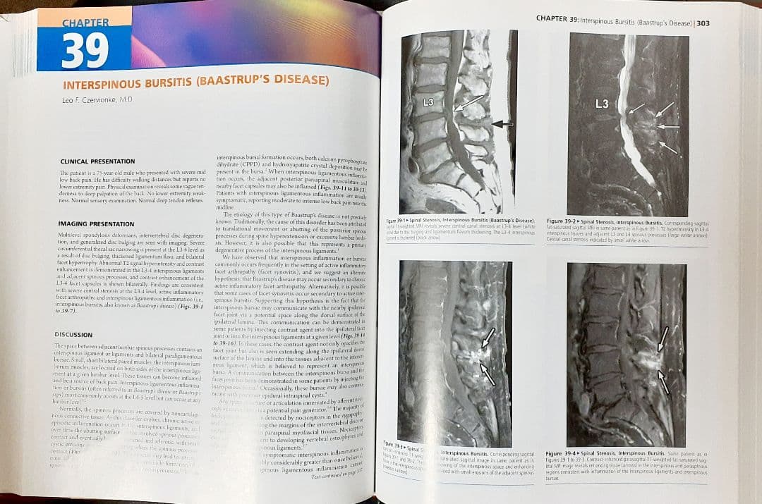 健康・医学 Imaging Painful Spine Disorders // 2011