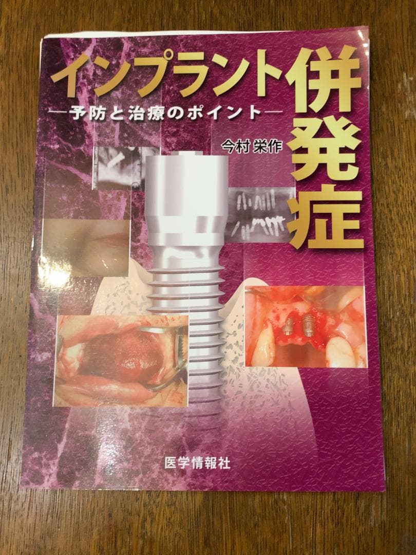 【裁断済み】インプラント併発症 - 予防と治療のポイント