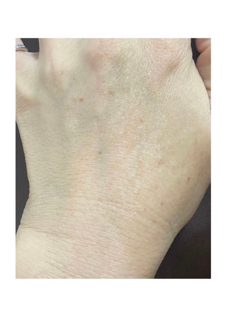 炭酸パック×６箱セット毛穴キュッとツヤ肌❣️赤字覚悟・春の大特価・在庫限り❣️