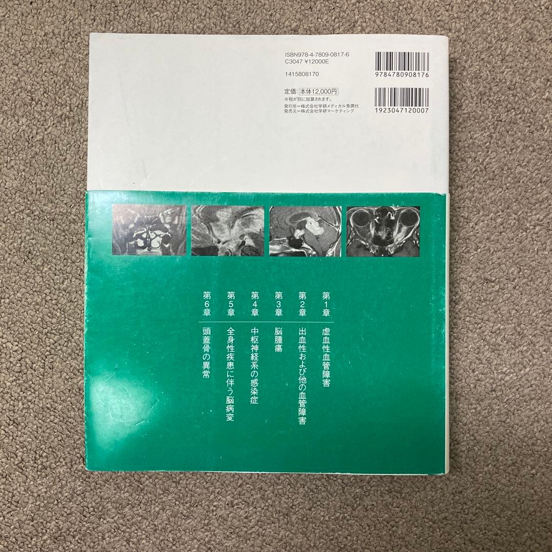 脳MRI 3 血管障害・腫瘍・感染症・他