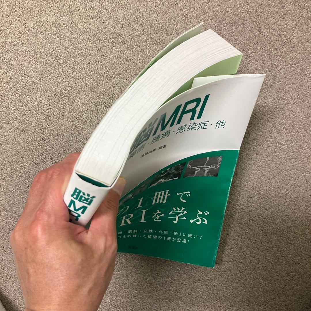 脳MRI 3 血管障害・腫瘍・感染症・他