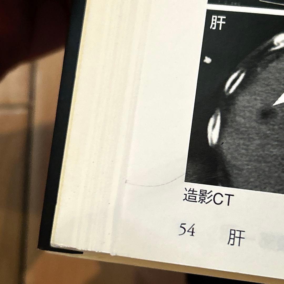 【絶版】腹部超音波テキスト 上・下腹部　改訂第3版　超音波検査士　ベクトルコア