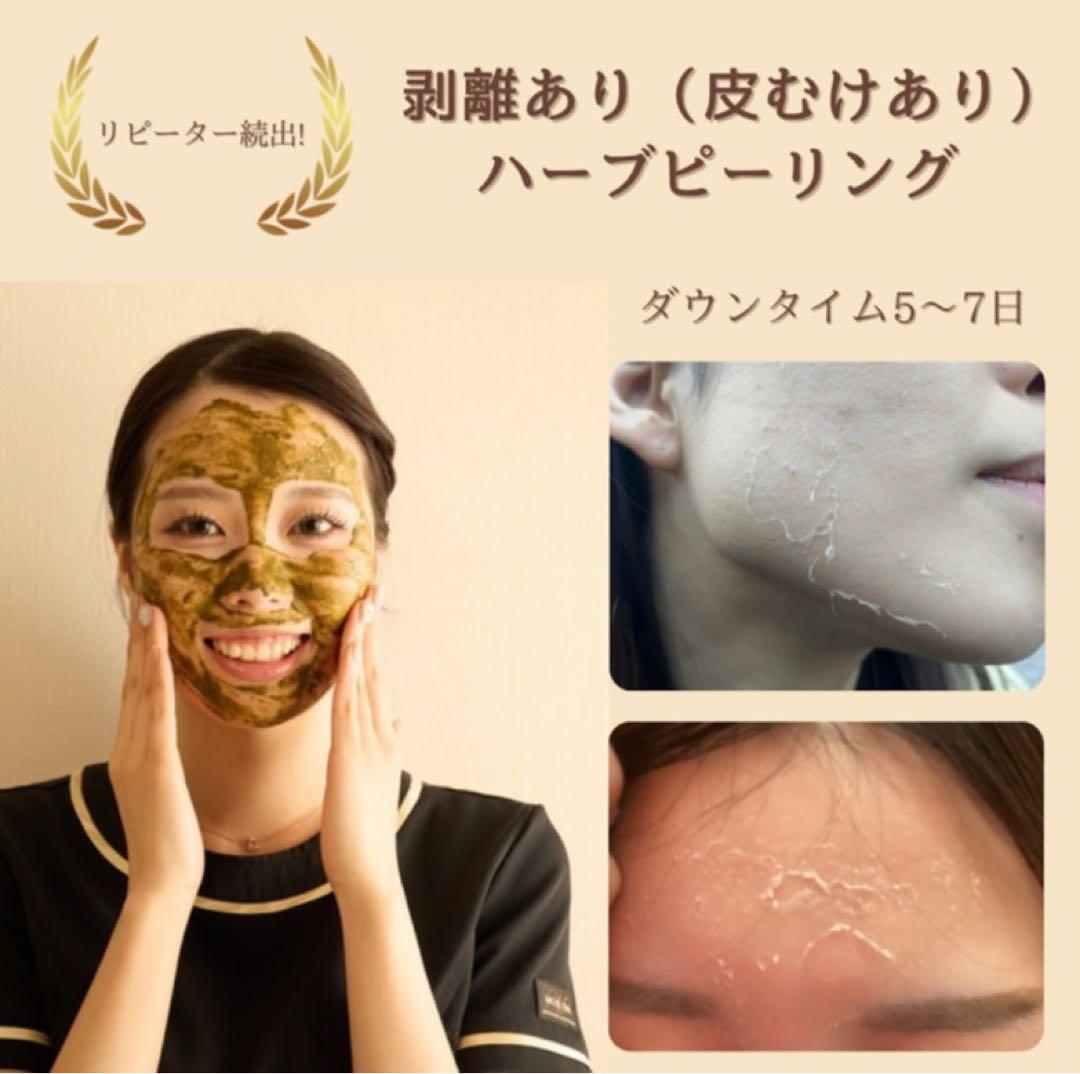 【12月31日まで年末セール】剥離ありハーブピーリング10回分