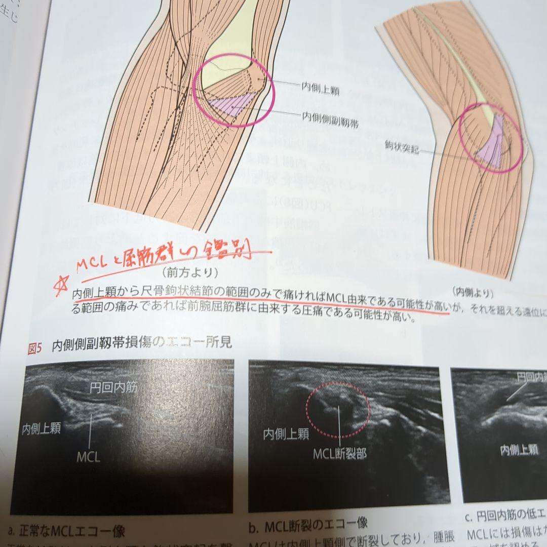 改訂第2版 機能解剖学的触診技術 整形外科運動療法ナビゲーション 4冊セット
