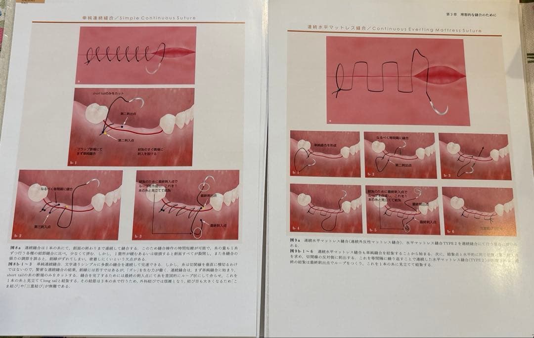 新時代の歯周外科　裁断済