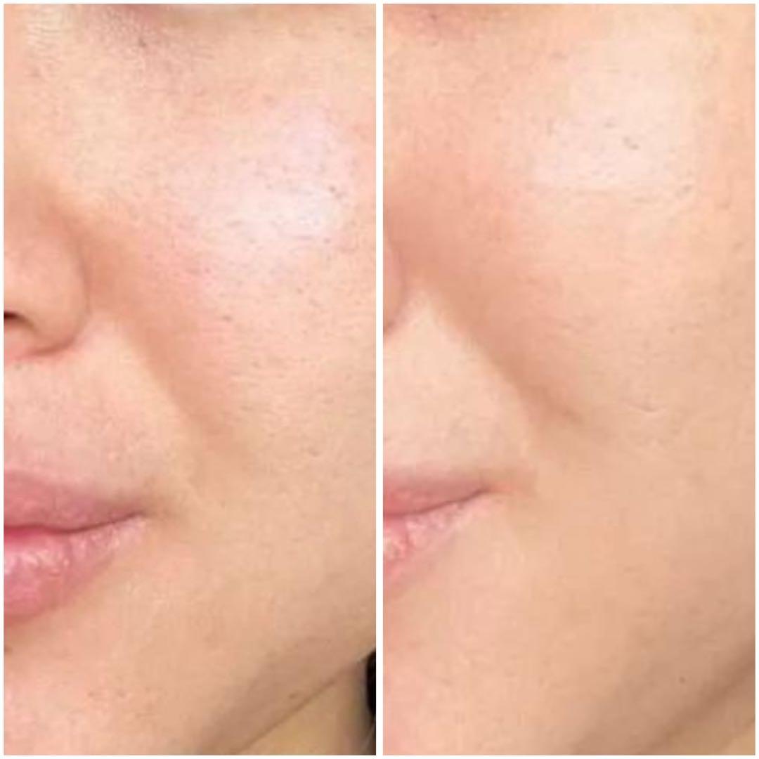 【プレミアム限定】グランスキンウェリテ　リミテッドエディション 2025