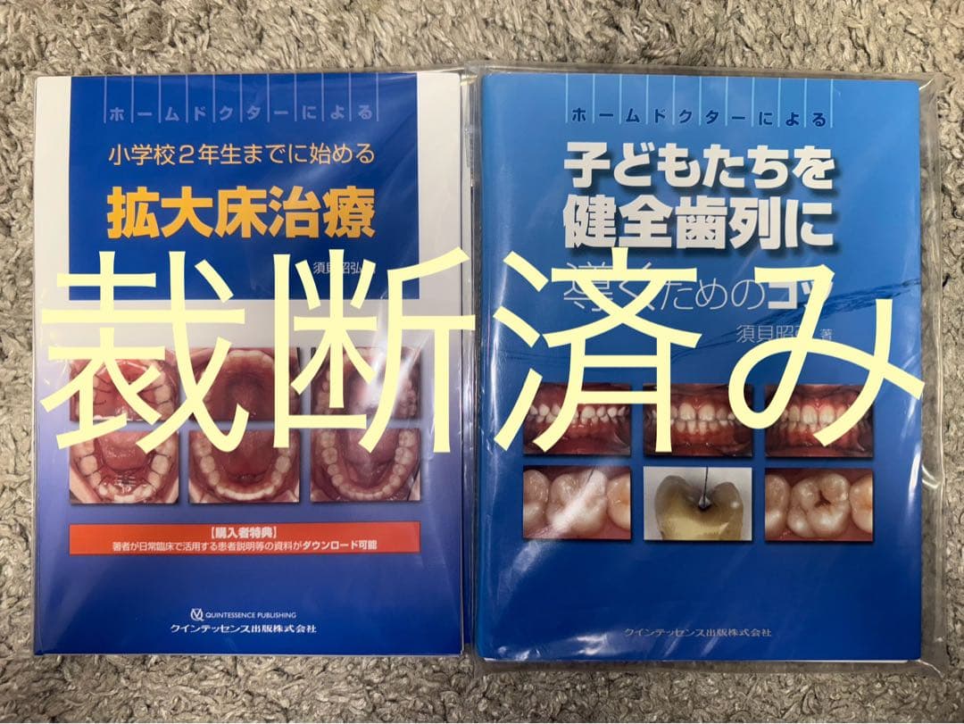 【裁断済み】須貝昭弘著　拡大床治療、子どもたちを健全歯列に導くためのコツ