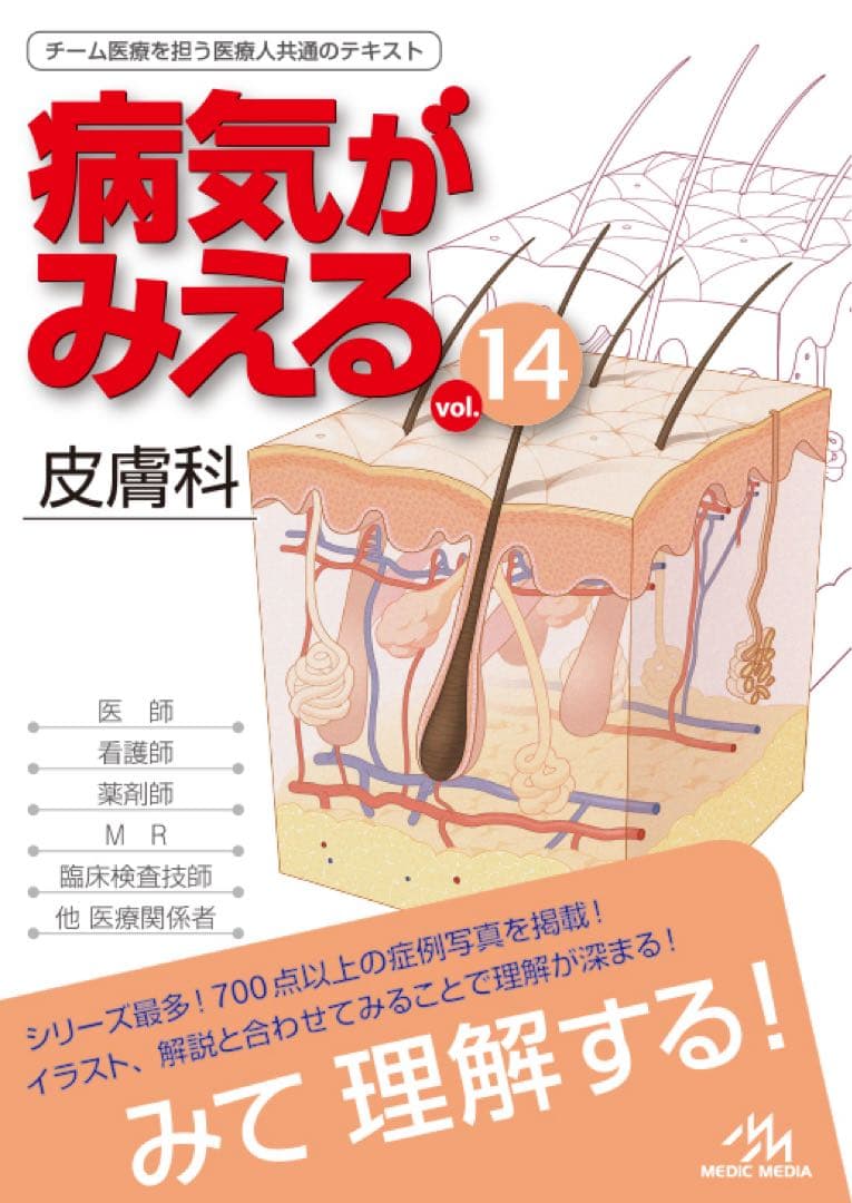 病気がみえる vol.14 皮膚科　王食晩餐さん