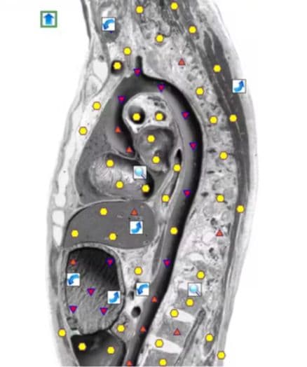 期間限定セール★波動測定器18D NLS メタトロン ニュースキャンヒーリング