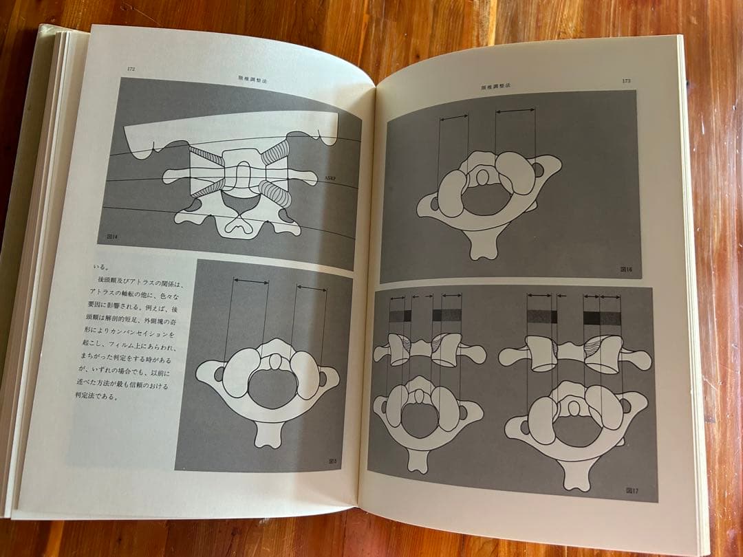 パーマー系　カイロプラクティック