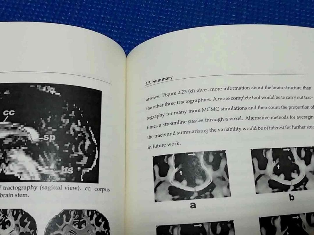 洋書 Statistical Analysis of Diffusion Tensor