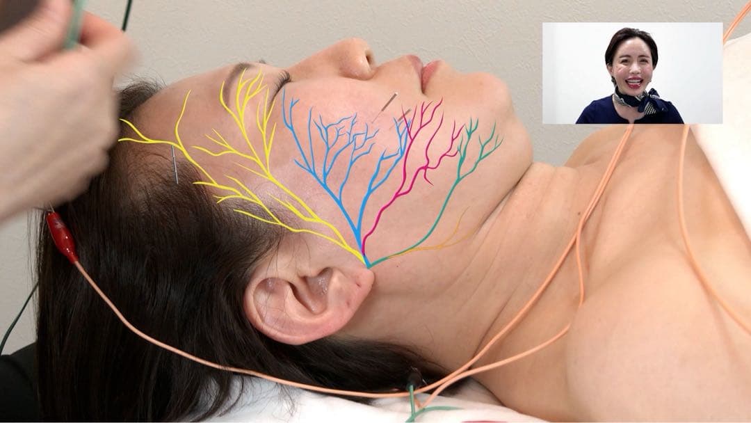 美容外科医複数人監修による美容鍼DVD